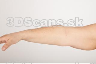 Photo reference of forearm 0001